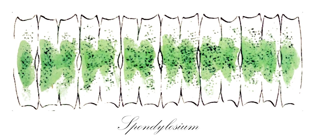 Spondylosium - Desmidiaceae,Biota,Plantae,Charophyta,Conjugatophyceae,Desmidiales,Desmidiaceae,Spondylosium